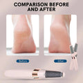 Pedicure Electronic Tool File Feet Callus Remover Hard Skin Remover Foot Care Tools